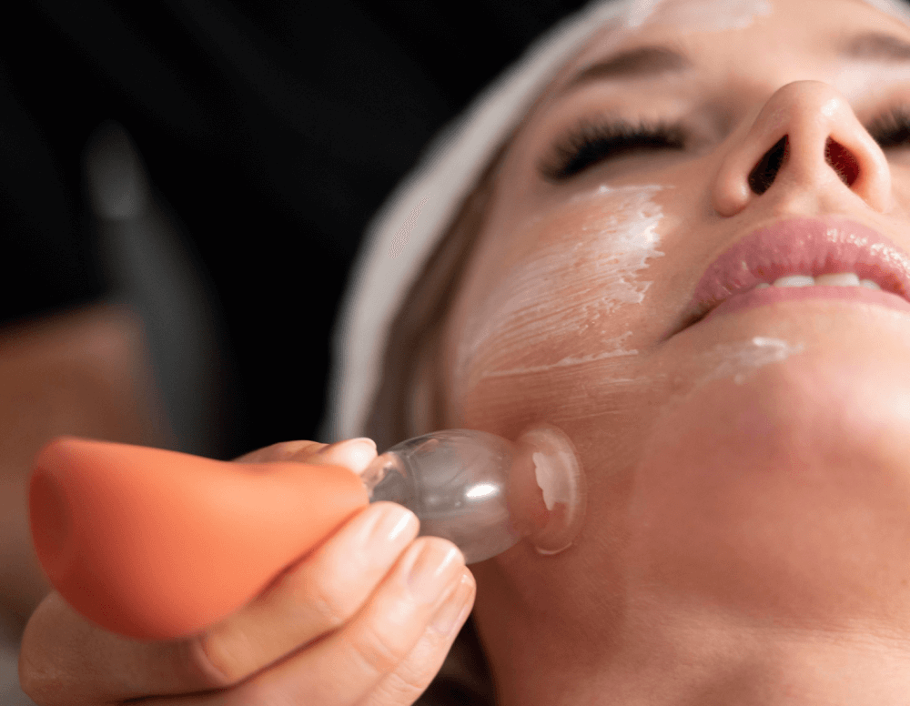 Cupping Facial Treatment